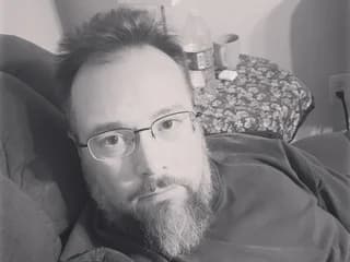 WebCAM de Allergictocam